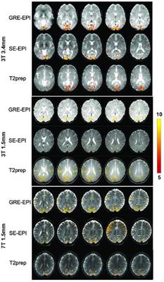 Evaluation of T2-prepared blood oxygenation level dependent functional magnetic resonance imaging with an event-related task: Hemodynamic response function and reproducibility